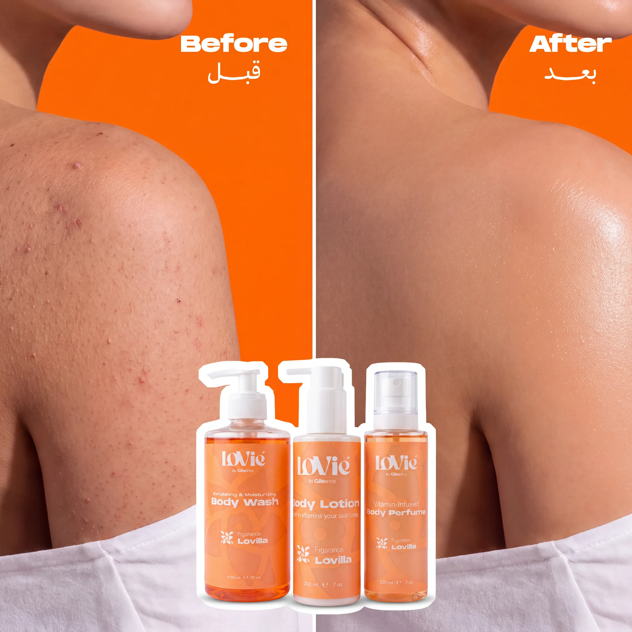 Square before-and-after static in orange: a shoulder shown blemished then clear, the Lovilla trio in front.